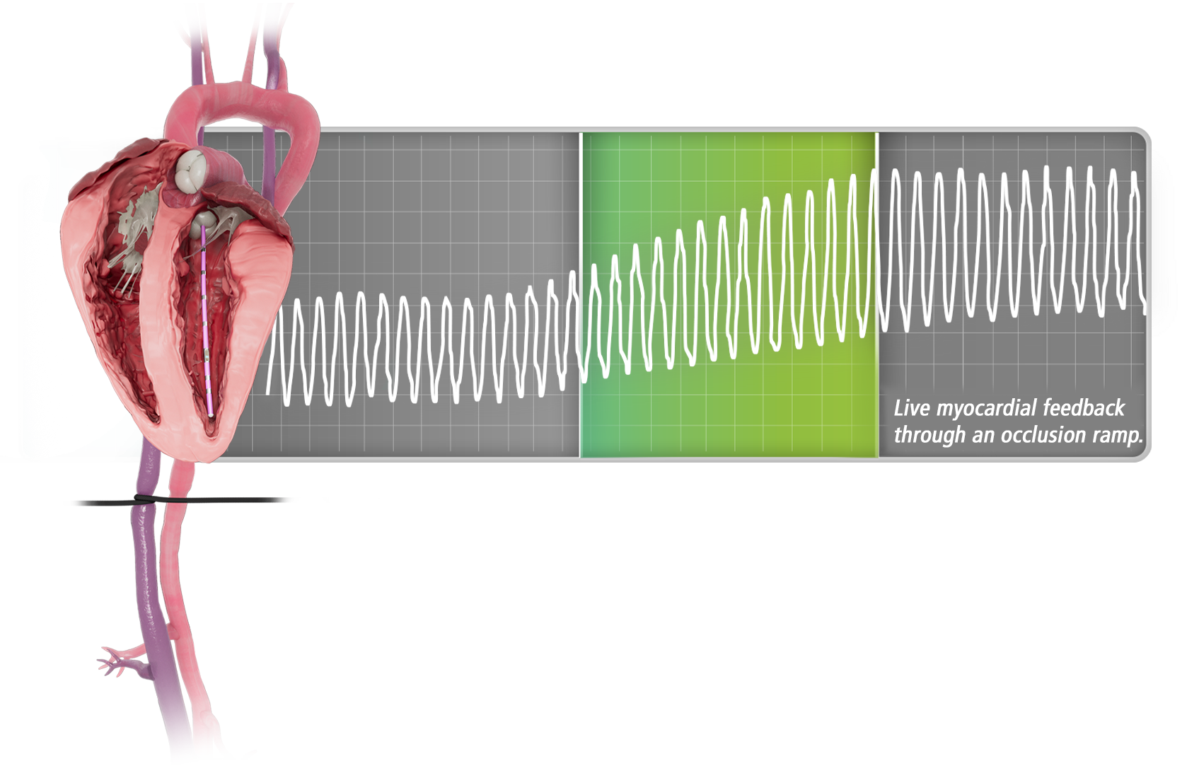 Occlusion-Step3