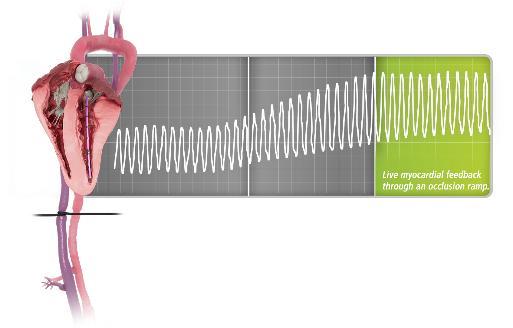 Occlusion-Step4