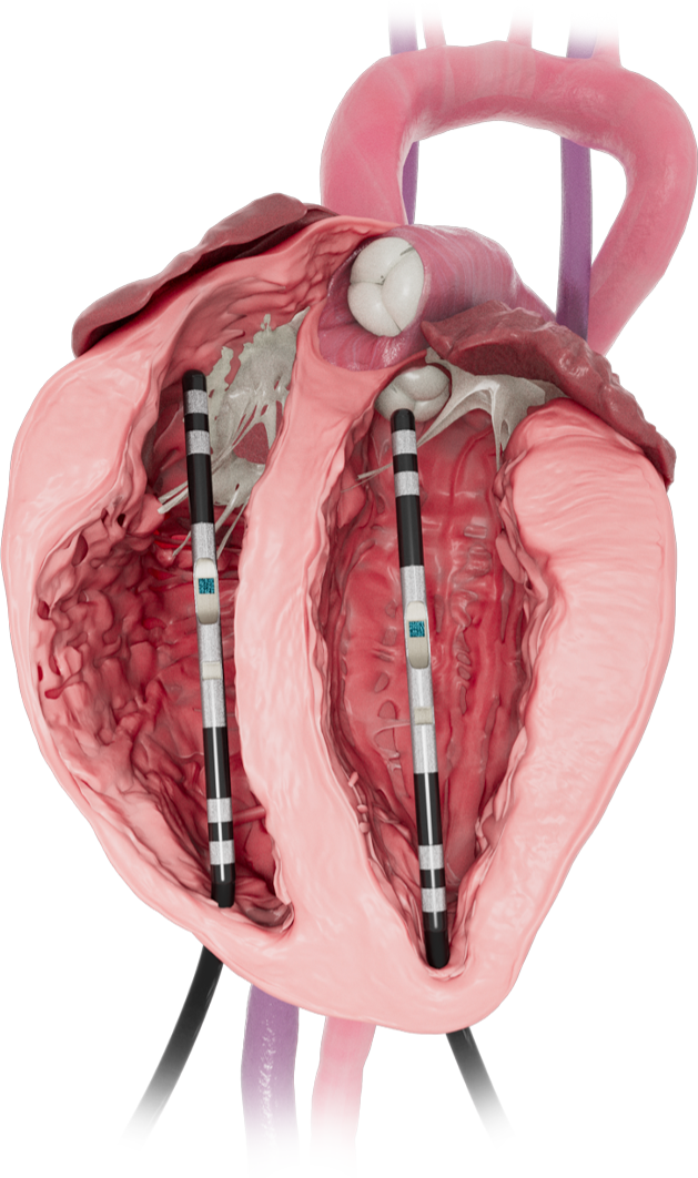 chest-catheterization-heart-img-2