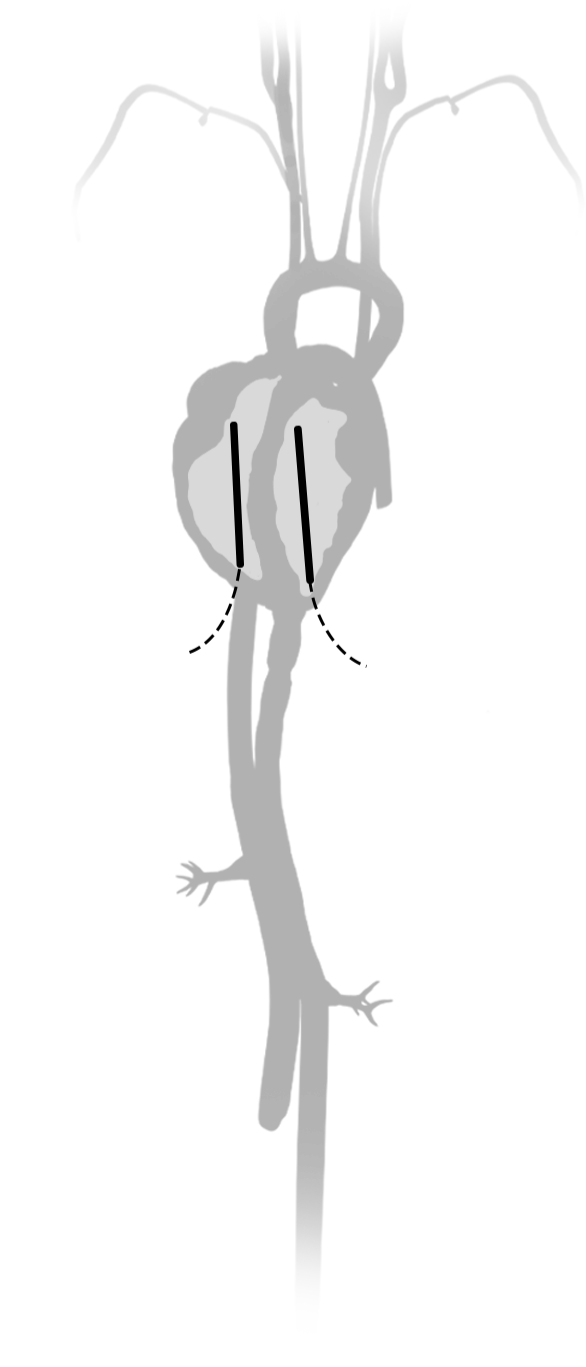 chest-catheterization-heart-img-3