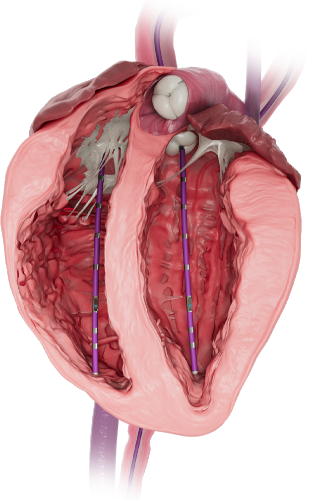 heart-img-1