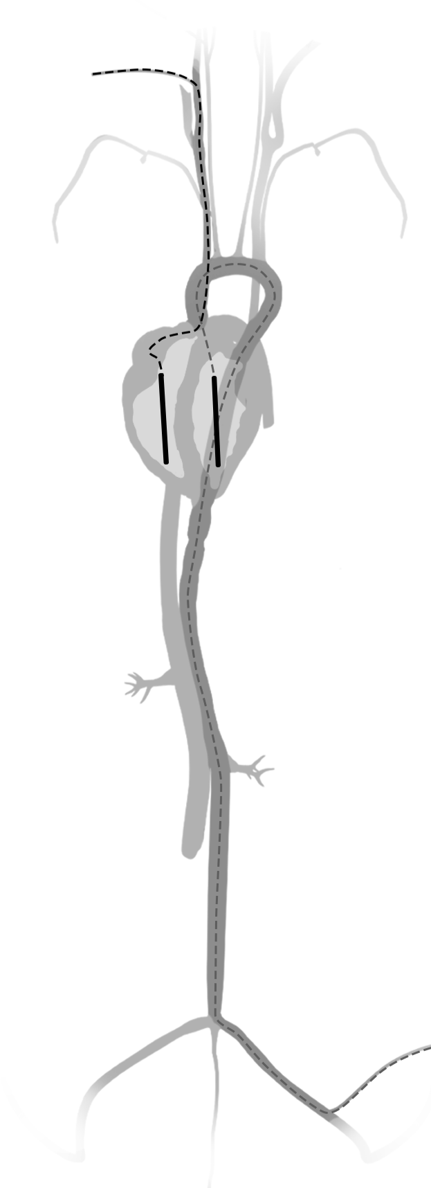 heart-img-2