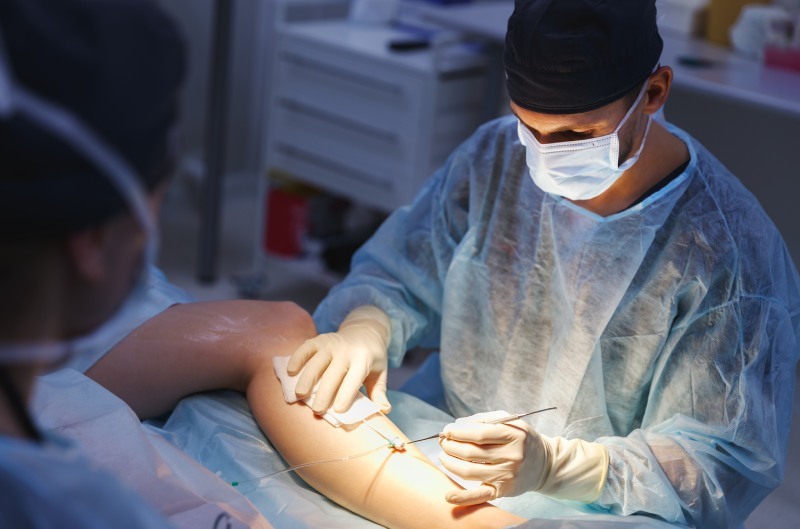 vascular-surgery