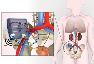 Kidney-Project
