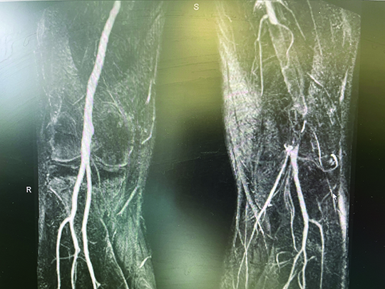 XRay of legs